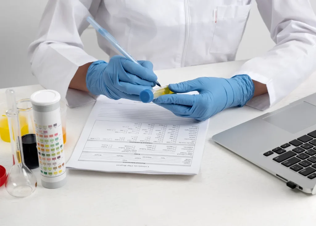 Lab technician analyzing a 5 panel drug test urine sample