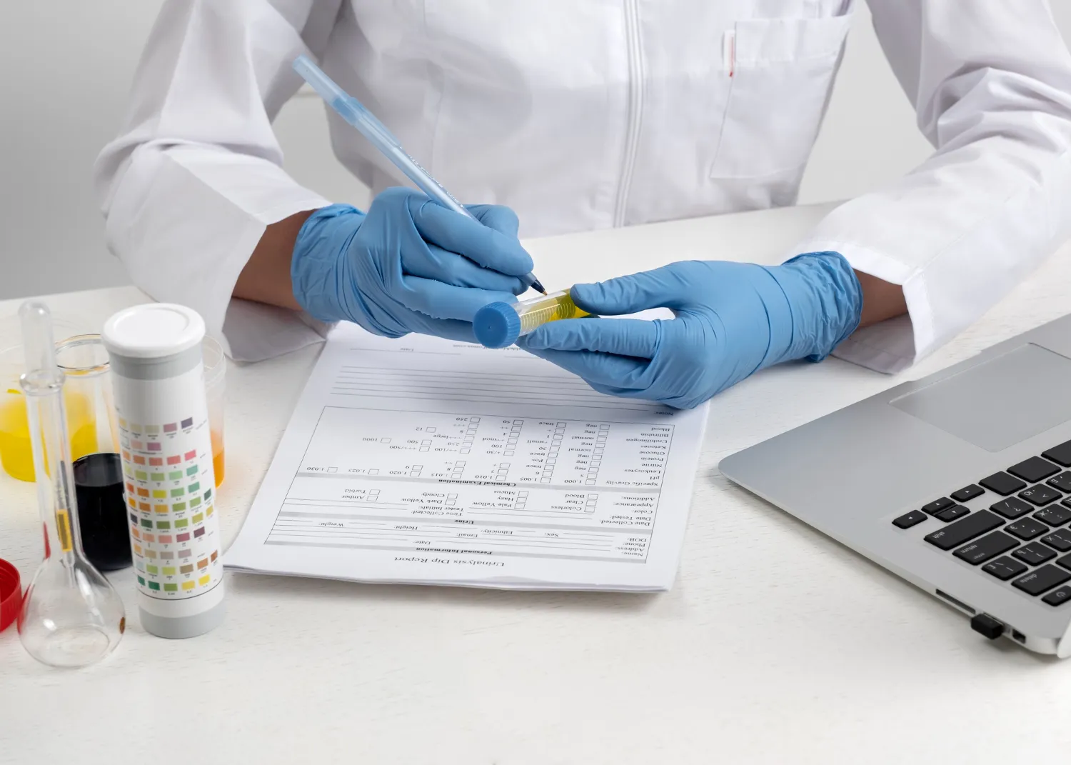 Lab technician analyzing a 5 panel drug test urine sample